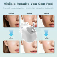 Hydrogen Oxygen Facial Machine, Hydro Facial Machine & Hydrodermabrasion Machine for Skin Care, Facial Vacuum Pore Cleaner, Hydro Dermabrasion Machine for Deep Cleansing & Hydration, Home Use.